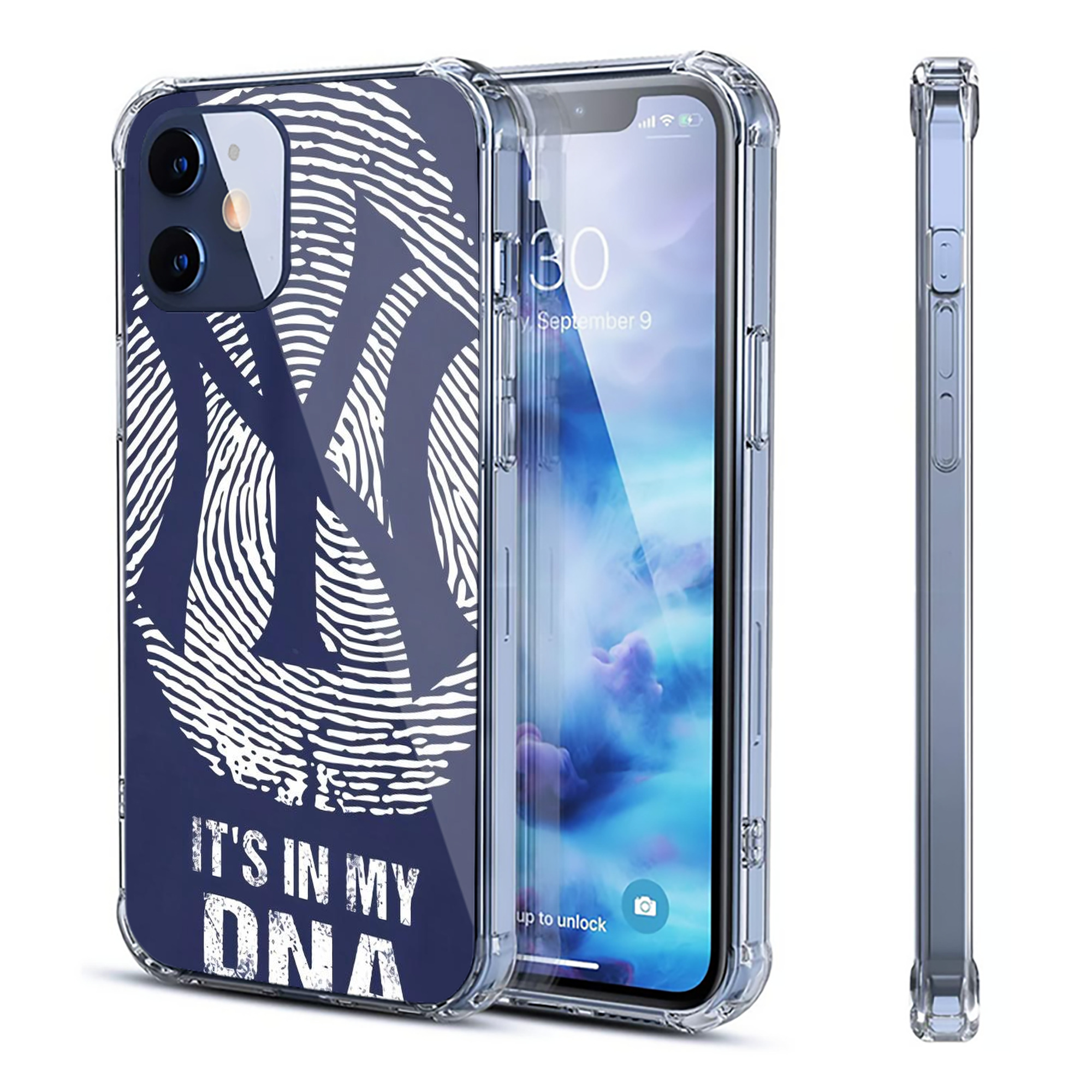 New York Yankees 145 Clear IPhone 12 Case – Soft TPU With UV Print – Enhanced Drop Protection, Precise Fit, Anti-Fingerprint, Customizable Design, Scratch-Resistant, Yellow-Resistant